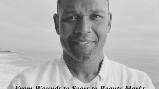 From Wounds to Scars to Beauty Marks - by Dr. Octavious Bishop